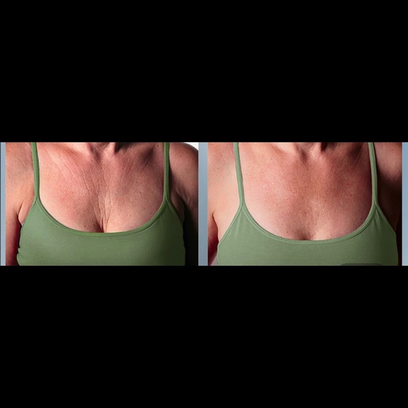 Chest wrinkle ease - Picture 5 of 6
